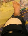 Picture Title - my leg