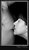 Love Bite