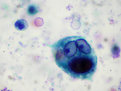Picture Title - Funny Things You See in a Microscope