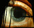 Eye or ...