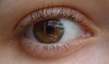 Picture Title - Eye