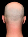 Picture Title - Shy Guy