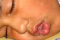 Picture Title - Fearless Sleep 