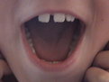 Picture Title - teeth