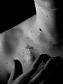 Picture Title - Scars