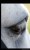 The eye