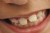 Happy Teeth