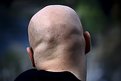 Picture Title - Baldie I