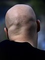 Picture Title - Baldie II